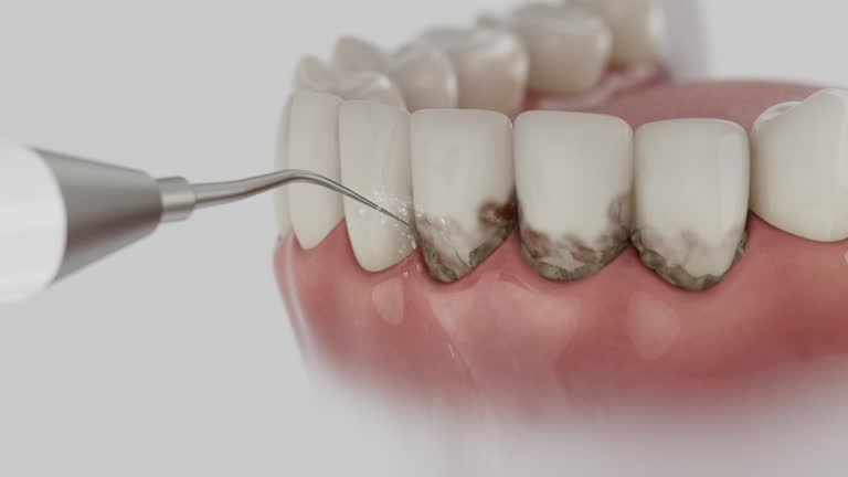 Trusted Root Canal Treatment service in Clearlake Oaks, CA - Dentist Open Now